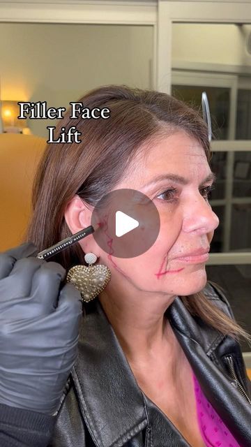 LIFTED BEAUTY on Instagram: "Filler Face Lift 🤩  To book an appointment text or call our office at (562) 331-6543   Click the link in our bio to see our online schedule to book an appointment with one of Our Medical Providers 📲 . Want More Info Before Coming in? Book A Free Consultation Call with Our Patient Care Coordinator ✨ . $45.00 Booking Fee Required To Book An Appointment 💰 . ⚠️Cancellation Policy ⚠️ $100 will be charged if appointment is not canceled within 48hrs of Scheduled Appointment Time . All products are FDA approved. Please visit the manufacturers website of the products that we use for all risk and side effects 🙌🏼 . All our treatments are customized to fit our patients anatomy and needs. Keep in mind that the number of units, syringes, threads or sessions needed will Threading Face Lift, Face Fillers Before And After Jaw, Filler Face Lift, Full Face Fillers Before And After, Mid Face Filler, Facial Fillers Before And After, Smile Line Fillers Before And After, Lower Face Lift Before And After, Face Fillers Before And After