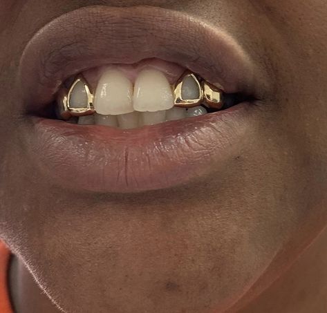 Side Tooth Grill, Grillz For Men, Men Grillz, Grillz Teeth Men, Grillz Men, Gold Teeth Grills, Open Face Grillz, Girl Grillz, Fang Grillz