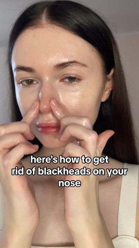 "✨ Blackhead Banishment 101: Unveil Your Clear Skin Secrets! 🌟💆‍♀️ Dive into a world of radiancy. Natural Beauty Face, Blackhead Remedies, Blackheads On Nose, Bad Acne, Rid Of Blackheads, Beauty Routine Tips, Natural Sleep Remedies, Get Rid Of Blackheads, Natural Cough Remedies