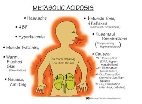 Road to RN — Metabolic Acidosis & Metabolic Alkalosis S&S Metabolic Acidosis, Acid Base Balance, Nurse Manager, Nursing Mnemonics, Nursing School Survival, Respiratory Therapy, Nurse Rock, Nursing School Studying, Nursing School Tips