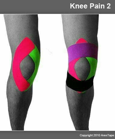 Lym Knee Taping For Pain, Kinesio Taping Knee, Knee Taping, K Tape, Kinesio Tape, Kt Tape, Studio Pilates, Kinesio Taping, Running Injuries