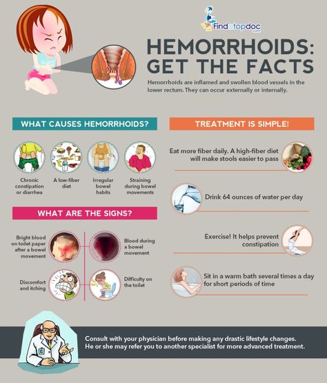 What is Hemorrhoids? Facts about Hemorrhoids [Infographic] Constipation Diet, Thrombosed Hemorrhoid, Hemorrhoid Remedies, Hemorrhoid Relief, Fiber Diet, High Fiber Diet, Learn Yoga, Blood Vessels, Facts About