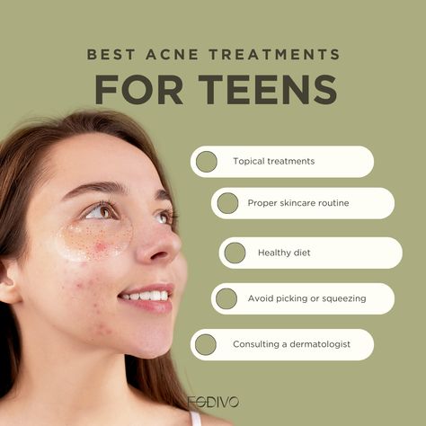 Discover the best acne treatments for a flawless complexion. 💫 Instagram Design Layout, Skincare Instagram, Skin Facts, Posts Ideas, Acne Treatments, Facebook Cover Design, Clear Skin Tips, Cosmetics Photography, Instagram Layout