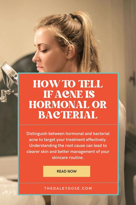 Discover the secrets to identifying hormonal versus bacterial acne with our expert insights! From the location of pimples to timing of breakouts, learn the key differences that can help you pinpoint the root cause of your skin woes. Take charge of your skincare routine and say goodbye to acne frustrations. #SkinCareExperts #ClearSkin #AcneAwareness How To Help Hormonal Acne, Best Products For Hormonal Acne, How To Fix Hormonal Acne, Hormonal Acne Skincare Routine, Chin Acne Remedies, Bacterial Acne, Nodule Acne, Hormonal Acne Diet, Hormonal Acne Supplements