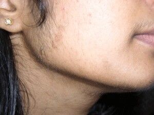 Female Sideburns, Female Facial Hair, Facial Hair Growth, Unwanted Hair Growth, Fitness Recipes, Community Health, Arabian Beauty Women, Normal Hair, Unwanted Hair