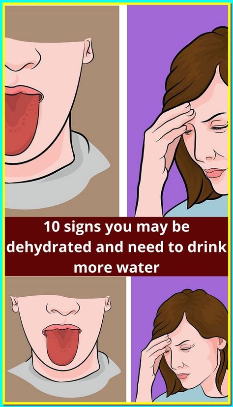 Dehydration Symptoms, Increase Height Exercise, Signs Of Dehydration, Aloe Vera Benefits, Drinking Enough Water, Natural Face Cleanser, Deserted Island, Healing Waters, Drink More Water