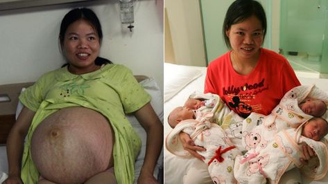 Farmer Woman Gives Birth to Quadruplets in China | Pregnant Life Woman Giving Birth, Farmer Woman, Pregnant Woman And Husband, Huge Pregnant Belly Quadruplets, Pregnant Life, Pregnant Women Giving Birth, Multiple Births, Giving Birth, Pregnant Belly