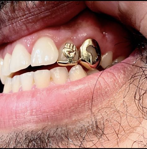 Girl Grillz, Dental Jewelry, Grillz Teeth, Diamond Grillz, Hand Jewelry Rings, Dope Jewelry Accessories, Gold Grillz, Grills Teeth, Tooth Gem