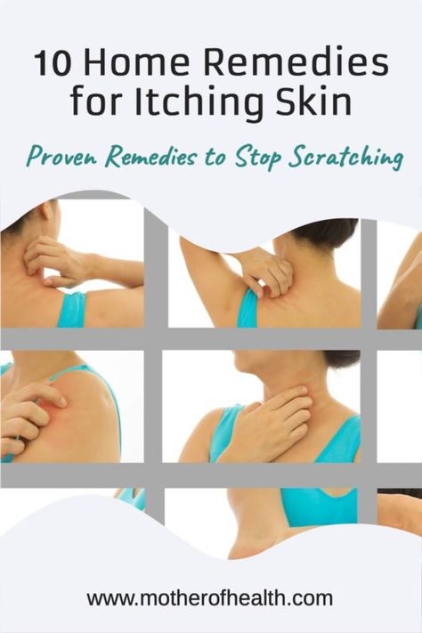 10 Home Remedies for Itching Skin | Mother Of Health Skin Itching, Itching Skin, Skin Care Routine 30s, Dry Skin Patches, Health Guide, List Of Things, Best Moisturizer, Itchy Skin, Natural Living