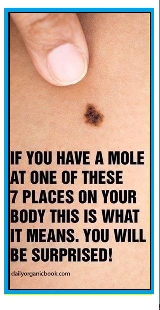 IF YOU HAVE A MOLE AT ONE OF THESE 7 PLACES ON YOUR BODY THIS IS WHAT IT MEANS. YOU WILL BE SURPRISED Tone Up Workouts, Mole Meaning, Tone Up, Natural Remedy, Shoulder Workout, About Women, Natural Treatments, Natural Medicine, Women's Health