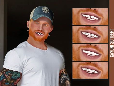 Cc Overlay, Grillz Teeth, Sims 4 Cc Eyes, The Sims 4 Skin, The Sims 4 Pc, Gold Grillz, Free Sims 4, Perfect Teeth, Sims 4 Cc Makeup