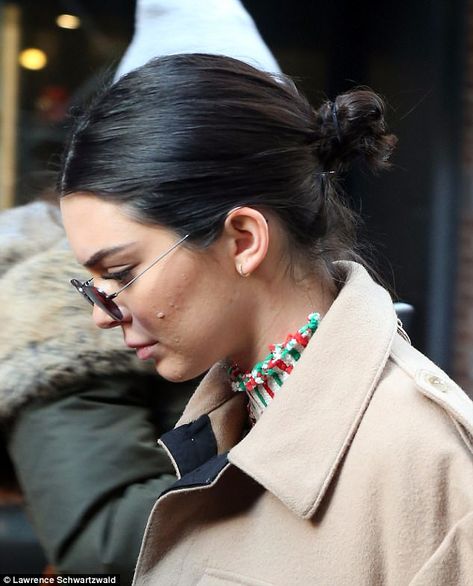 Kendall Jenner Earrings, Kendall Jenner Acne, Acne Positive, Kendall Jenner Skin, Kendall Jenner Short Hair, Girl With Acne, Acne Positivity, Acne Fighter, Body Positive Photography