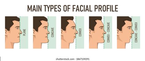 Strech Marks Remedies, Flat Forehead, Convex Profile, Facial Profile, Types Of Facial, Types Of Facials, Skull Reference, Face Profile, Editorial Illustration