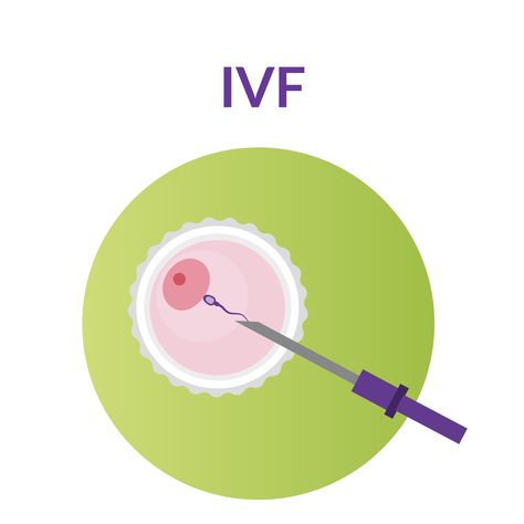 IVF, IVF financing, IVF budgeting, embryo transfer, IVF meds IVF cycle, egg retrieval, egg donor, sperm donor, sperm retrieval, fresh donor egg, frozen donor egg, ICSI, PGT, assisted hatching, embryo storage, IVF insurance, company fertility benefits, ivf clinic Egg Retrieval, Frozen Embryo Transfer, Ivf Cost, Egg Donor, Sperm Donor, Ivf Cycle, Ivf Clinic, Embryo Transfer, In Vitro Fertilization