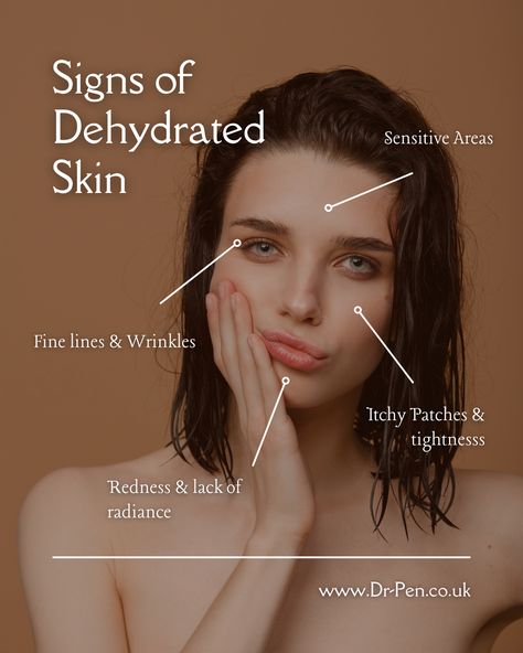 Look out for the signs of dehydrated skin in the coming winter months, make sure to stock up on your favourite moisturiser! 

#microneedling #dermaroller #skincare #collagenboosting #glowingskin #skinrenewal #microneedlingbenefits #healthyskin #skincareroutine #dermapen #skinrejuventation #youthfulskin #beautytreatment #flawlesscomplexion #radiantskin #microneedlingtherapy #skinrevival #beautysecrets #dermapenfacial #collageninductiontherapy #microneedling101 #skincaresoloutions #glowgetter Skin Facts, Women Skin, Beauty Products Photography, Derma Roller, Skin Clinic, Itchy Skin, Dehydrated Skin, Skin Tips, Skin Concern