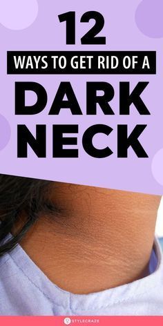 How To Get Rid Of Dark Neck: 13 Effective Home Remedies To Try How To Get Rid Of Dark Neck At Home, Neck Hyperpigmentation, Dark Skin Around Neck, Dark Neck Remedies, Get Rid Of Dark Neck, Dark Neck, Detox Body, Wrinkle Remedies, Skin Advice