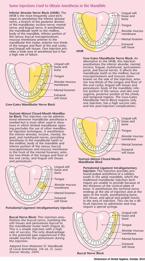 Dental Anatomy Dental, Dental Assistant Study Guide, Dental Terminology, Dental Assistant School, Dental Hygienist School, Local Anesthesia, Dental Assistant Study, Dental Hygiene Student, Kedokteran Gigi