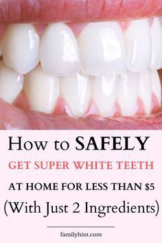 Whiten Teeth Naturally, Whiten Your Teeth At Home, Baking Soda Teeth, Baking Soda Teeth Whitening, Teeth Whitening Methods, Teeth Whitening Homemade, Get Whiter Teeth, Teeth Whitening Remedies, Teeth Whitening Diy