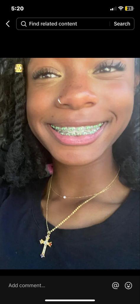 Light Green Braces, Mint Braces, Lime Green Braces, Chain Braces, Power Chains, Brace Colors, Power Chain Braces, Braces Journey, Braces Ideas