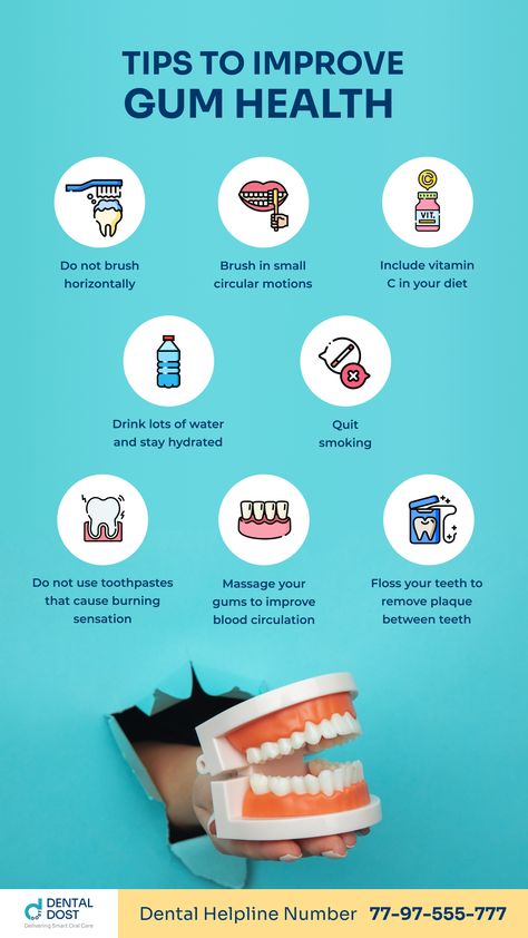 -Do not brush horizontally
-Brush in small circular motions
-Floss your teeth to remove plaque between teeth
-Do not use toothpastes that cause burning sensation
-Massage your gums to improve blood circulation
-Drink lots of water and stay hydrated
-Include vitamin c in your diet
-Quit smoking Tooth Decay Remedies, Healthy Gums, Tongue Health, Brush Your Teeth, Menstrual Health, Oral Care Routine, Receding Gums, Gum Care, Gum Health