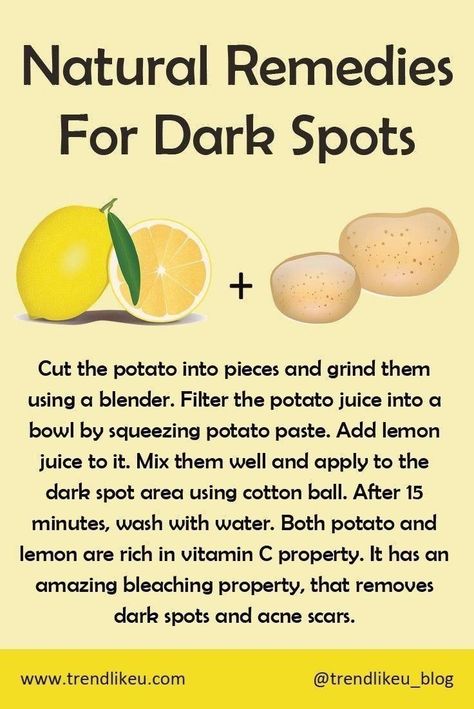 Homemade Skin Care For Dark Spots, Potato Skin Care Dark Spots, Natural Remedies For Dark Spots, Homemade Dark Spot Remover, Natural Remedies For Dark Spots On Face, Potato Face Mask Dark Spots, Natural Face Skin Care For Dark Spots, Fall Facials, How To Remove Dark Spots On Face