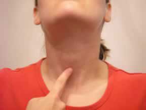 Laryngopharyngeal Reflux (LPR) / Acid Reflux (Common Cause of Phlegmy Throat/Mucus in the Throat) Vocal Cord Dysfunction, Lump In Throat, Acid Reflex, What Is Gerd, Acid Reflux Home Remedies, Silent Reflux, Reflux Baby, Reflux Remedies, Gerd Diet