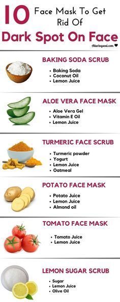 Try these proven home remedies to get rid of dark spots on face. #Darkspots #organicskincare Potato Face Mask, Face Baking, Baking Soda Coconut Oil, Potato Face, Baking Soda Scrub, Tomato Face, Skin Care Routine For 20s, Acne Dark Spots, Dark Spots On Face