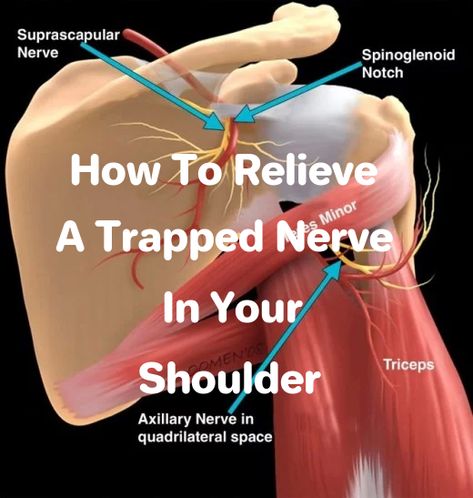 How to Relieve a Trapped Nerve in Your Shoulder | Patient's Lounge Pinched Nerve In Shoulder, Shoulder Pain Remedies, Pinched Nerve In Neck, Trapped Nerve, Nerve Pain Remedies, Neck Pain Exercises, Shoulder Pain Exercises, Neck And Shoulder Exercises, Shoulder Impingement