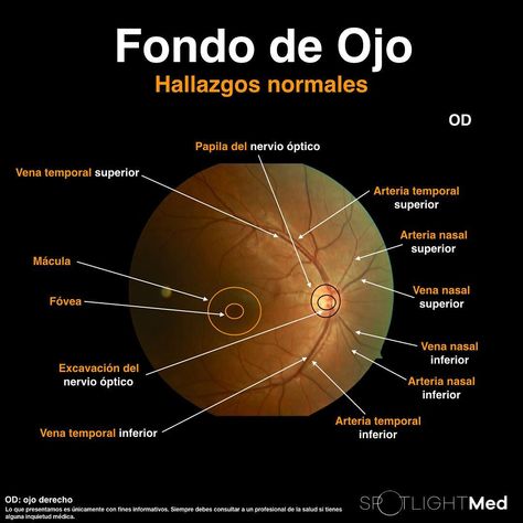 Fondo de ojo normal 👁 #SpotlightMed #SpotlightMedicine #oftalmología #oftalmology #fondodeojo #Medicine #Medicina #MedStudent #medlifestyle… Eye Anatomy, Medicine Notes, Medical Quotes, Medical Posters, Medicine Student, Medical Anatomy, Medicine Doctor, Hospitality Management, Med Student