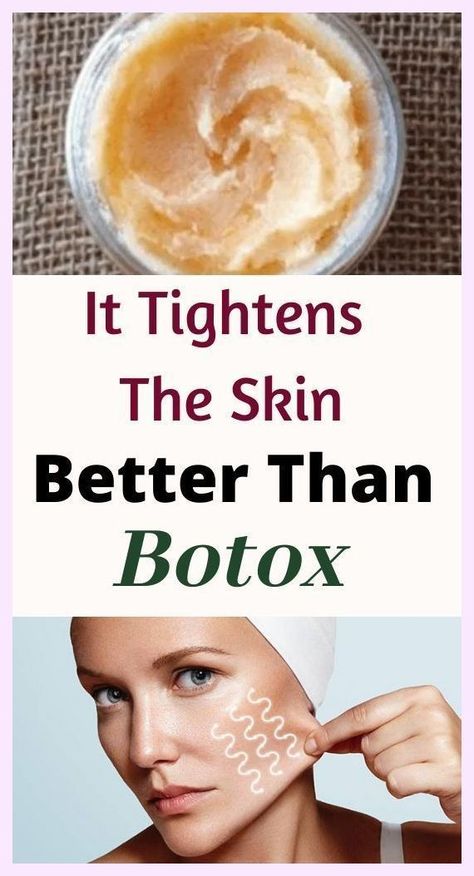 Skin Tightening Homemade Wrinkle Cream That Works Better Than Botox Homemade Wrinkle Cream, Coffee Face Mask, How To Remove Pimples, Gorgeous Skin, Homemade Face Masks, Homemade Face, Skin Complexion, Wrinkle Cream, Natural Home Remedies