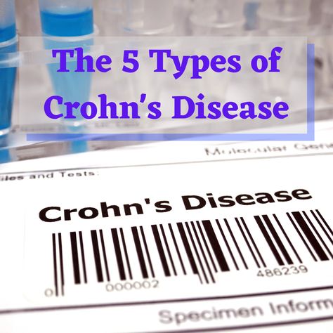 The 5 Types of Crohn’s Disease - Crohn’s is a type of Inflammatory Bowel Disease (IBD) characterized by chronic inflammation and erosion of the intestines. Unlike Ulcerative Colitis, which only affects the colon, Crohn’s can affect any part of the digestive tract. Symptoms can range in severity, just like the disease itself from mild to severe. Symptoms can include; abdominal pain, fever,