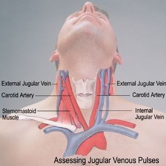 Anatomy Of The Neck, Neck Veins, Cardiac Assessment, Jugular Vein, Radiology Student, Basic Anatomy And Physiology, Nurse Study Notes, Nursing Student Tips, Medical Student Study