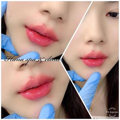 Lip Filler Shape Ideas Korean, Korean Cherry Lips Filler, Korean Lip Filler, Ideal Lips, Lip Ideas, Txt Magic, Korean Fashion Kpop Inspired Outfits, Korean Lips, Facial Treatments