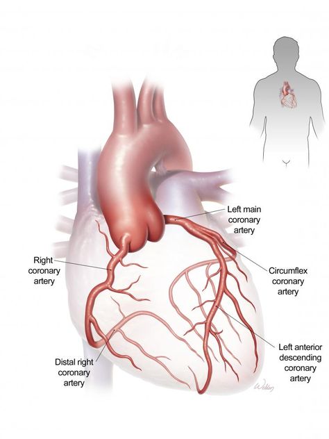 Coronary Artery Disease and Coronary Bypass Surgery Cath Lab Nursing, Coronary Circulation, Arteries Anatomy, Cardiothoracic Surgery, Coronary Artery, Arteries And Veins, Heart Anatomy, Cardiac Nursing, Bypass Surgery