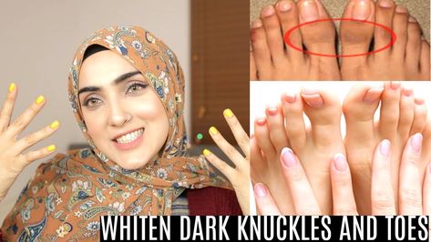 How To Lighten Knuckles, Lemon Juice For Skin, Diy Hand Cream, Dark Knuckles, Glowing Cream, Diy Pedicure, Skin Hand, Hand Scrub, Lightening Creams