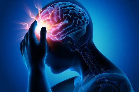 Signs a Migraine Is Coming Migraine Attack, Migraine Pain, Headache Types, Migraine Prevention, Severe Headache, Migraine Headaches, Sciatica, Neck Pain, Migraine