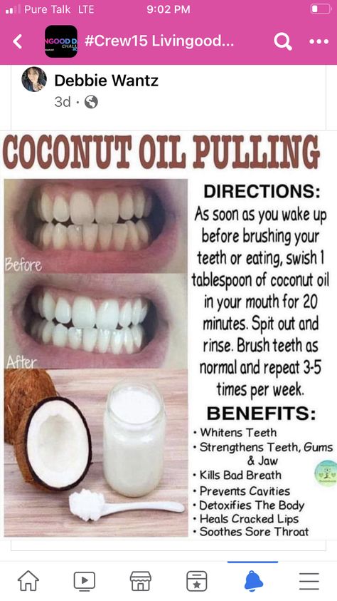 Strong Teeth, Teeth Whitening Homemade, Strengthen Teeth, Teeth Whitening Remedies, Teeth Whitening Diy, Resep Diet, Coconut Oil Pulling, Teeth Health, How To Prevent Cavities