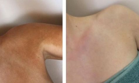 How To Fix Self Tanner Mistakes, Remove Self Tanner From Hands, Self Tanner Remover Diy, Remove Self Tanner From Skin, How To Remove Self Tanner From Skin, How To Remove Self Tanner, Coco And Eve Self Tanner, Diy Self Tanner, Best Self Tan