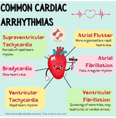 Arrhythmias Notes, Cardiac Arrhythmias, Sonography Student, Nurse Things, Paramedic School, Nurse Study, Cardiac Rhythms, New Grad Nurse, Nursing School Essential