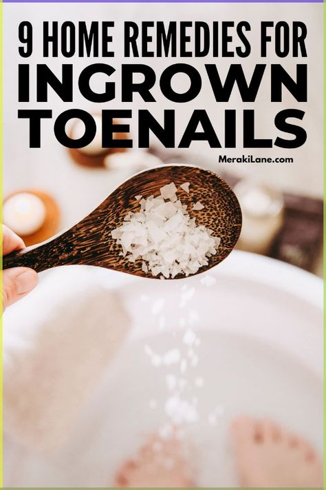 nail infection remedy home How To Treat Ingrown Toenail, Nails Remedies, Toenail Pain, Nail Remedies, Blackhead Remover Diy, Nail Care Diy, Antifungal Cream, Fruit Recipes Healthy, Nail Trimming