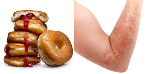 4 Signs You Might Be Allergic To Sugar Insulin Resistance Symptoms, Sugar Symptoms, Food Issues, Health And Wellness Center, Health And Fitness Magazine, Low Blood Sugar, Grilling Gifts, Gluten Sensitivity, Ate Too Much