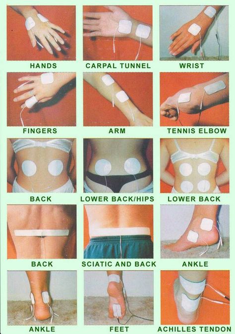 1000+ images about Terapia Física y salud integral on Pinterest ... Tens Placement, Tens Electrode Placement, Tens Unit Placement, Tens And Units, Tens Machine, Tens Unit, Tens Ems, Ten Unit, Tennis Elbow