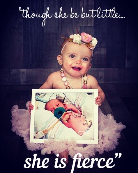 #36weeker #nicu #preemie #nicugrad #miraclebaby #firstbirthday #preemiepictureidea Twin Birthday Pictures, Premature Baby Development, Baby Birthday Quotes, 1st Birthday Quotes, Baby Birthday Photoshoot, First Birthday Photography, 1st Birthday Pictures, 1st Birthday Photoshoot, First Birthday Pictures