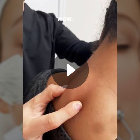 So Satisfying👉👃👈 - Dermatology | Snapchat Neck Pimples, Cystic Pimple, So Satisfying, Consumer Health, Dermatology, Snapchat, Beauty