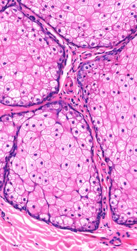 Pathology Wallpaper, Histology Wallpaper, Histology Aesthetic, Sebaceous Hyperplasia, Heart Histology, Histology Art, Liver Histology, Lung Histology, Microscopic Cells