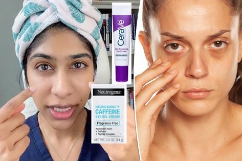 I’m a dermatologist — here are 3 simple ways to get rid of those annoying under-eye bags Get Rid Of Under Eye Bags, Arnica Gel, Baggy Eyes, Under Eye Bags, Beauty Foods, Eye Gel, Eye Bags, Best Oils, Puffy Eyes