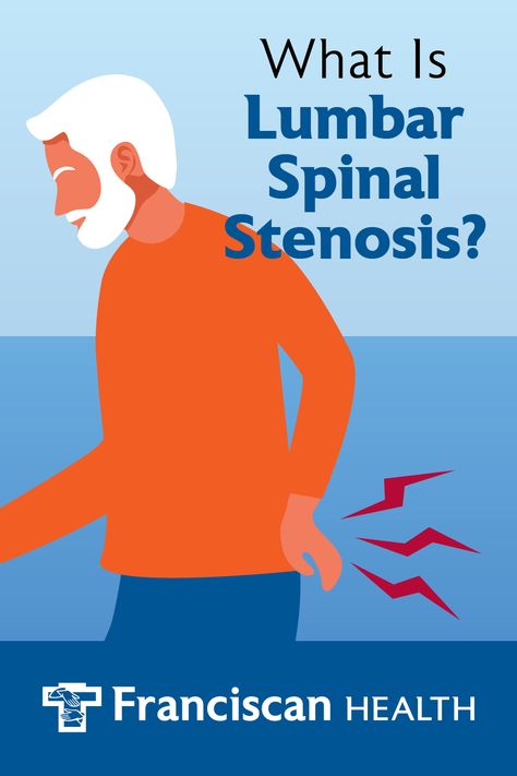 Stenosis Of The Spine, Stenosis Exercises, Sciatic Nerve Stretches, Nerve Anatomy, Spinal Fusion, Piriformis Syndrome, Spinal Nerve, Pinched Nerve, Neck Exercises