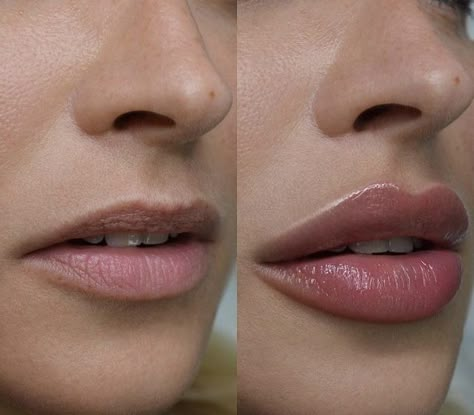 Lips Aesthetic, Lip Permanent Makeup, Lips Inspiration, Permanente Make-up, Face Fillers, Botox Lips, Facial Fillers, Facial Aesthetics, Lip Filler