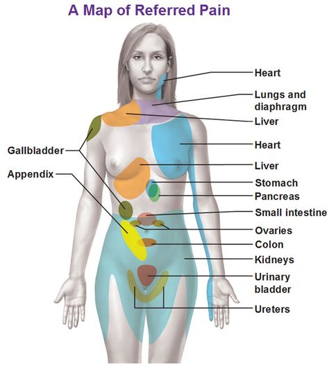 Referred Pain, Nursing Tips, Medical Knowledge, Medical Information, Female Body, Anatomy And Physiology, The Human Body, Health Info, Massage Therapy