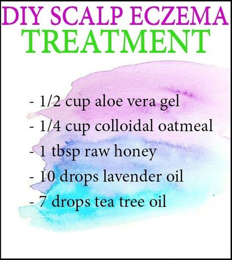 Itchy Scalp Causes, Dry Scalp Remedy, Natural Beauty Treatments, Natural Beauty Hacks, Flaky Scalp, Aquaponics System, Hair Rinse, Itchy Scalp, Dry Scalp